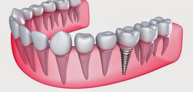 اسماء الاسنان بالانجليزي وأهمية التعرف على أسماءهم باللغات الأجنبية