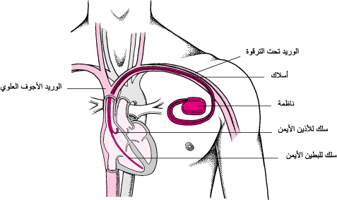 أي جزء من جهاز القلب الصناعي يؤدي الوظيفة الرئيسية للقلب